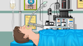 Stomach Surgery