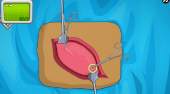 Appendix Surgery