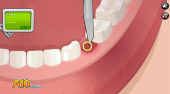 Operate Now! Dental Implant