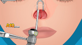 Operate Now! Nose Surgery