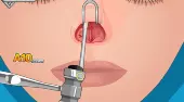 Operate Now! Nose Surgery