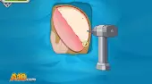 Operate Now! Epilepsy Surgery