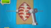 Operate Now! Scoliosis Surgery