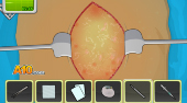 Operate Now! Pacemaker Surgery