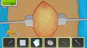 Operate Now! Pacemaker Surgery